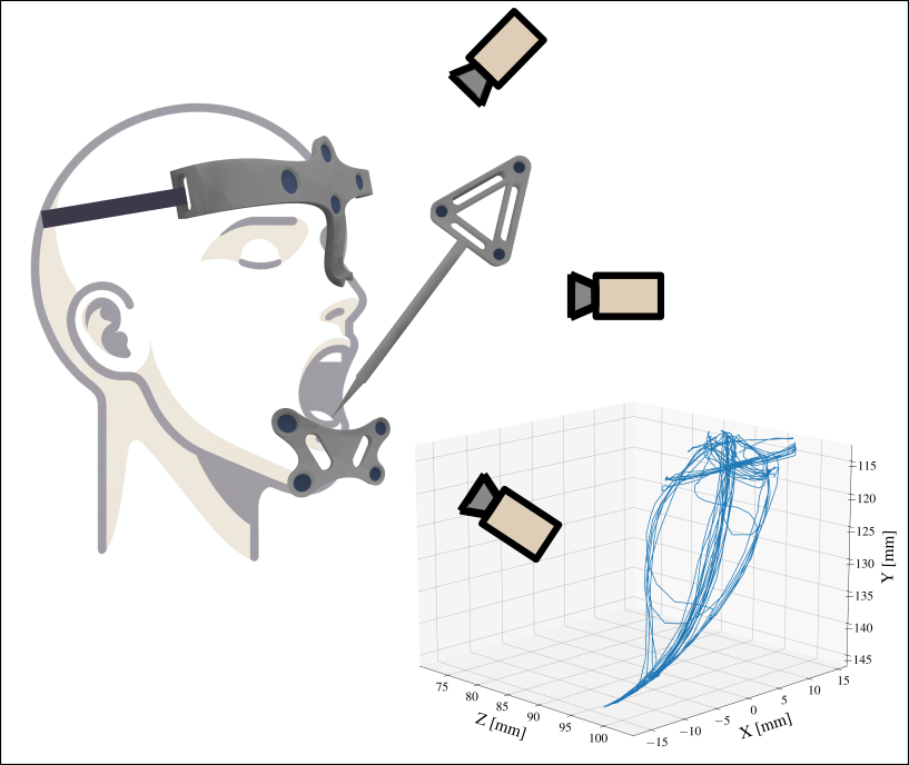 sensors_2025_jaw_tracking_setup.png